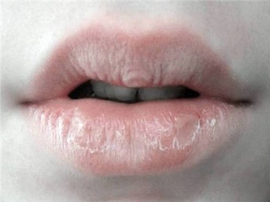 Cách để khắc phục phun môi không đều màu? 