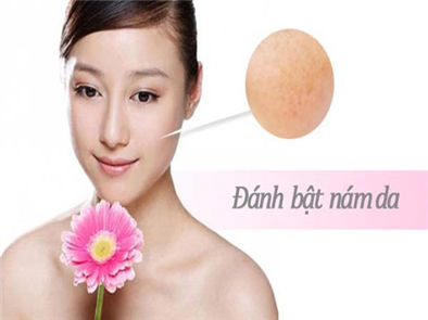 Trị nám bằng công nghệ peeling an toàn mà hiệu quả.