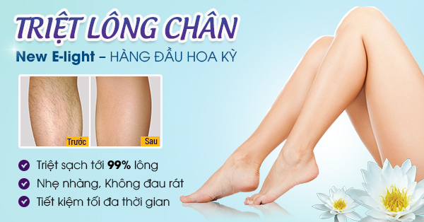 triệt lông bằng máy elight